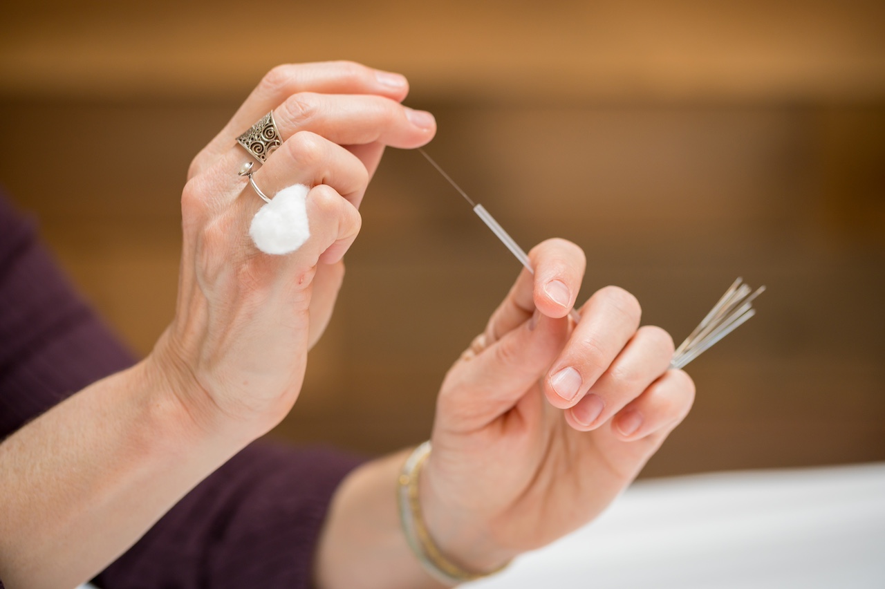 Suzanne Lafrance acupuncture