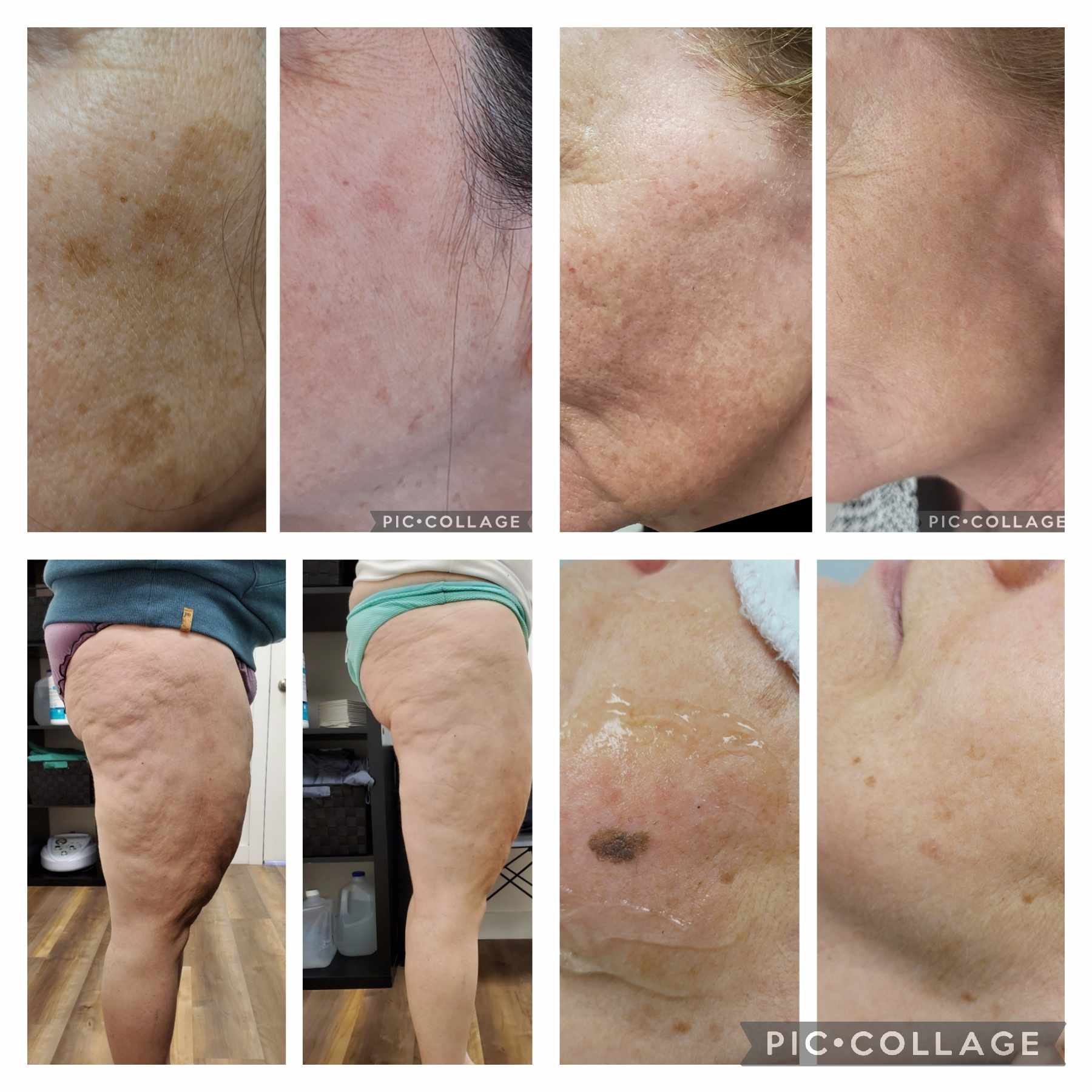 Clinique Laser Mobile