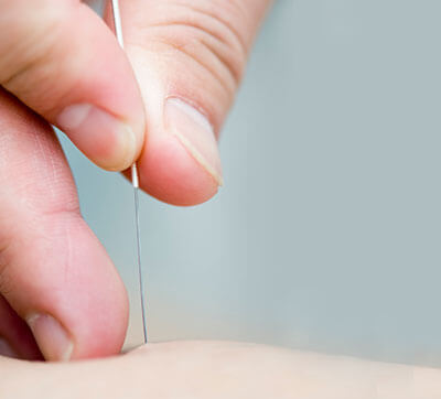 Acupuncture chemin Sainte-Foy